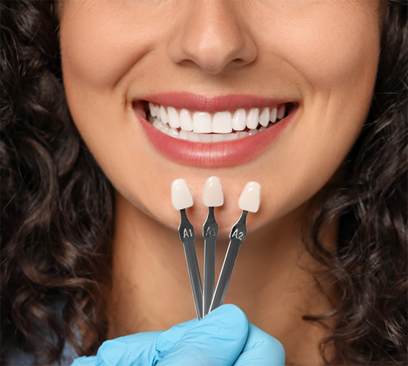Close up of woman having teeth shade matched for veneers