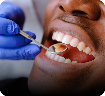 Using dental mirror to examine male patient's mouth