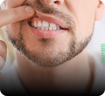 Man pulling up lip to show gums