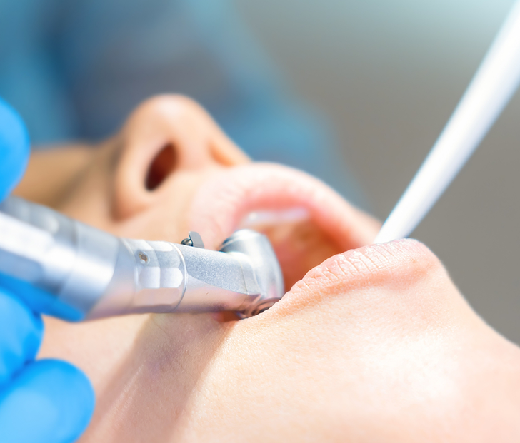 Close up of patient's mouth during a tooth extraction